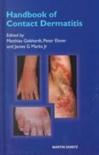 Image of Handbook of contact Dermatitis